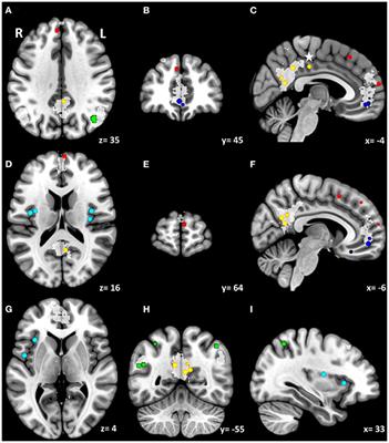 Mindfulness in the focus of the neurosciences - The contribution of neuroimaging to the understanding of mindfulness